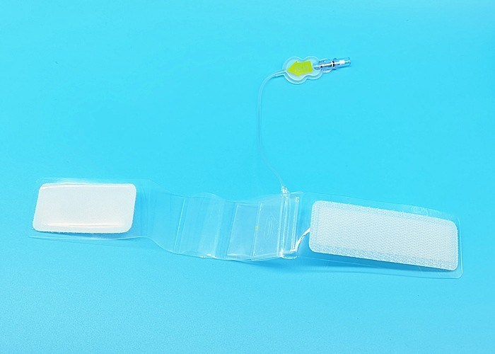 Disposable Cardiac Surgical Arterial Radial Hemostasis Compression Device
