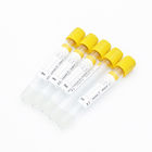 CE Certified Vacuum Venous Vacuum Blood Collection Gel And Clot Activator Yellow Cap Tube