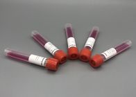 Ethylene Oxide Sterilization VTM Disposable Virus Delivery Media